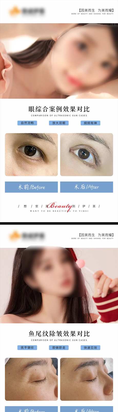 医美案例对比模版-采灵感-https://www.cailinggan.com/