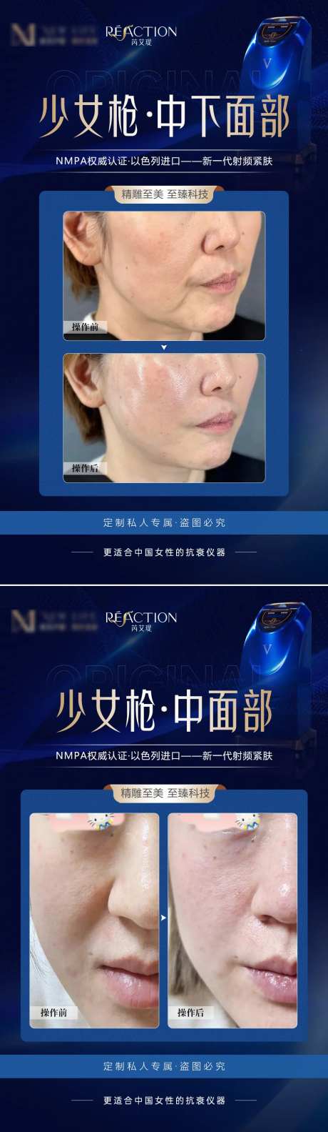 医美少女枪案例对比海报-采灵感-https://www.cailinggan.com/