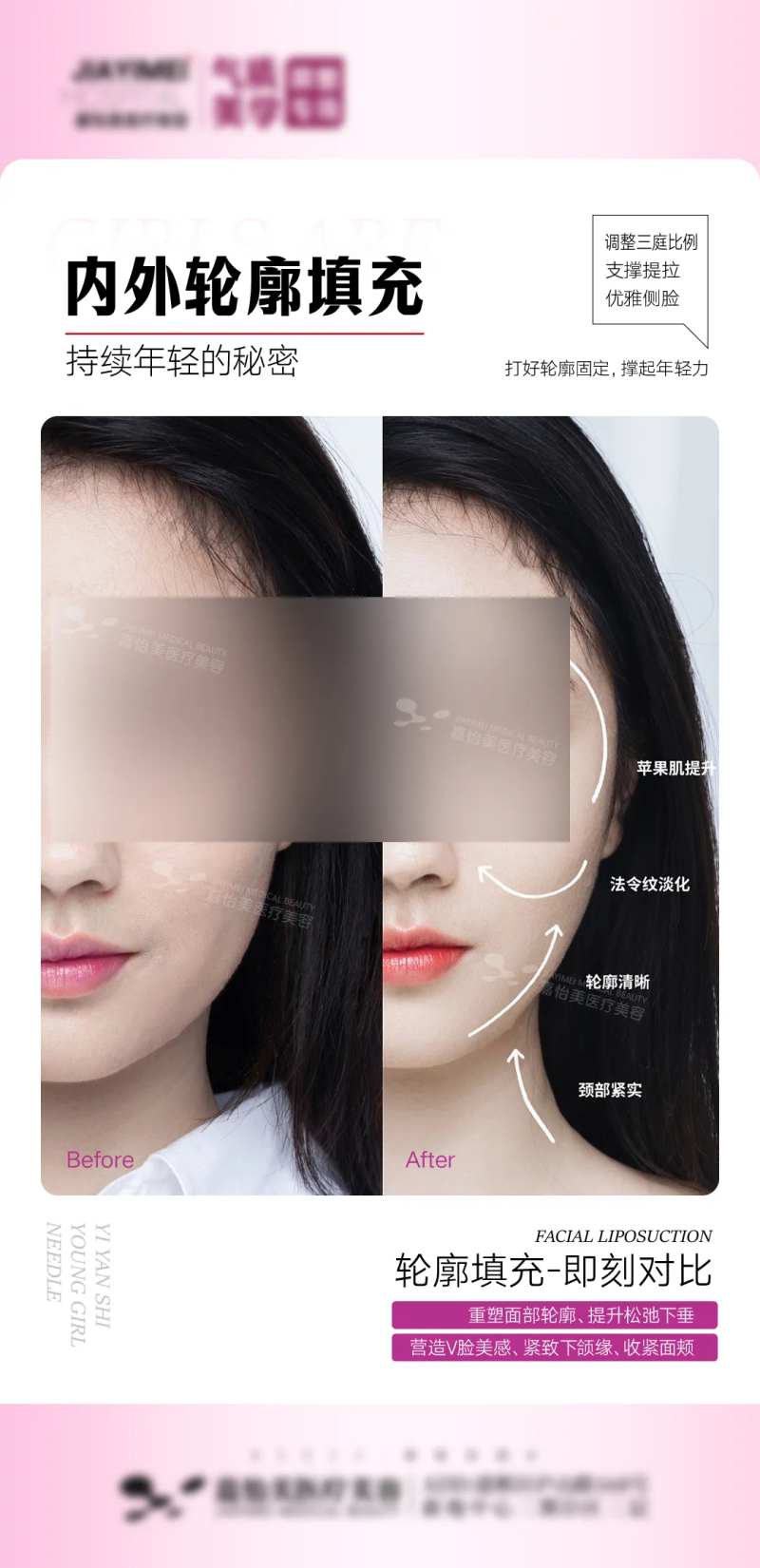 内外轮廓填充案例海报-采灵感-cailinggan.com