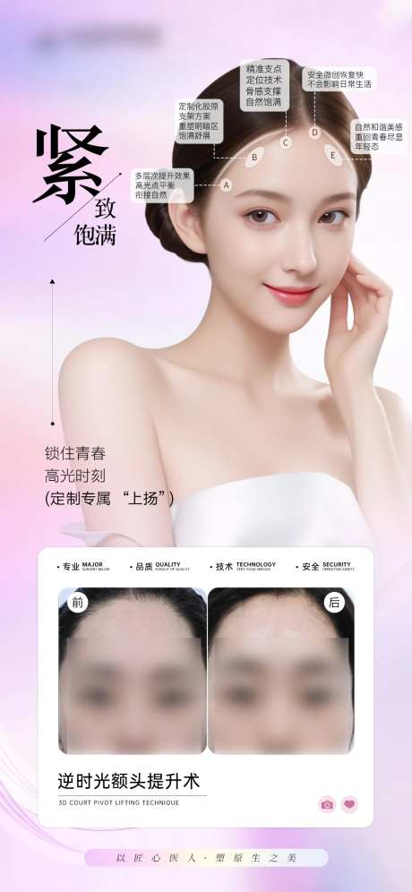 医美额头提升案例对比-采灵感-https://www.cailinggan.com/