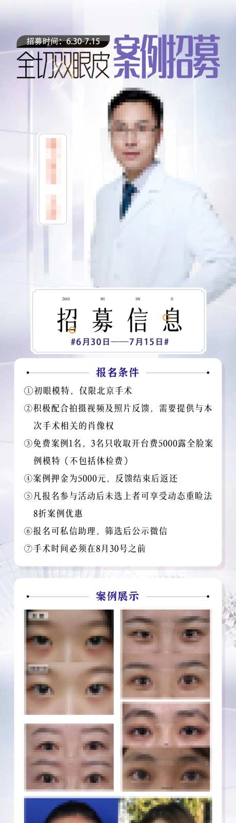 双眼皮案例招募长图海报-采灵感-https://www.cailinggan.com/