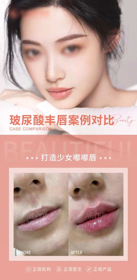 医美丰唇海报-采灵感-https://www.cailinggan.com/