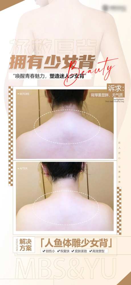 少女背医美海报-采灵感-https://www.cailinggan.com/