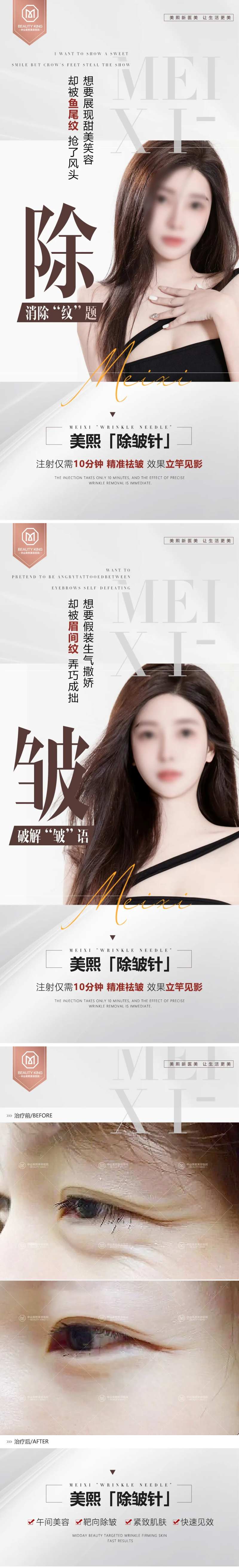 医美除皱针朋友圈宣传海报-采灵感-cailinggan.com