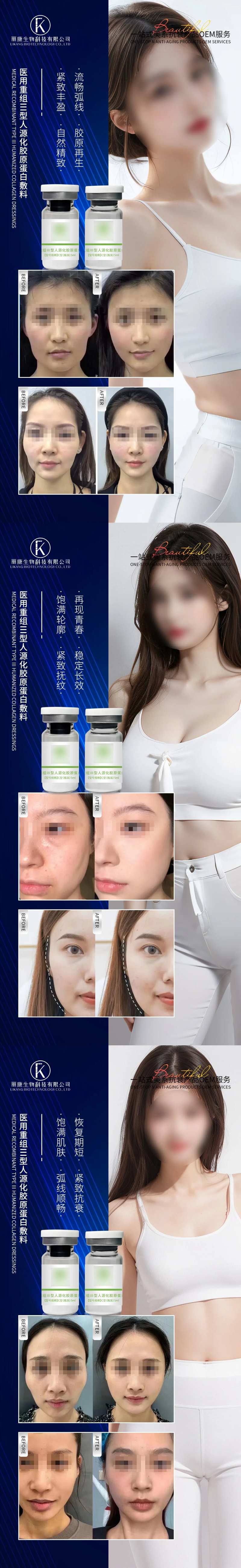 医用重组III型胶原蛋白填充海报-采灵感-cailinggan.com