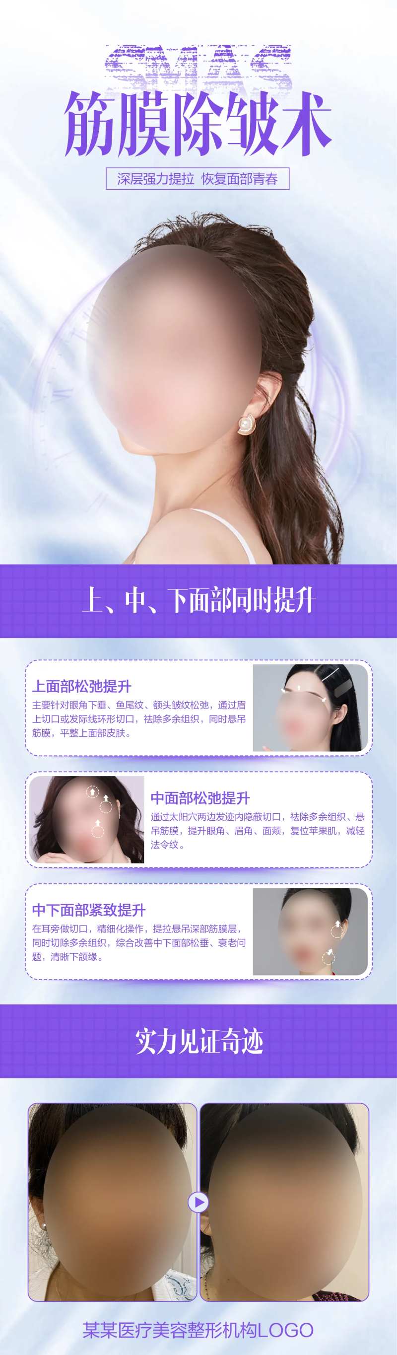 SMAS筋膜除皱术海报-采灵感-cailinggan.com