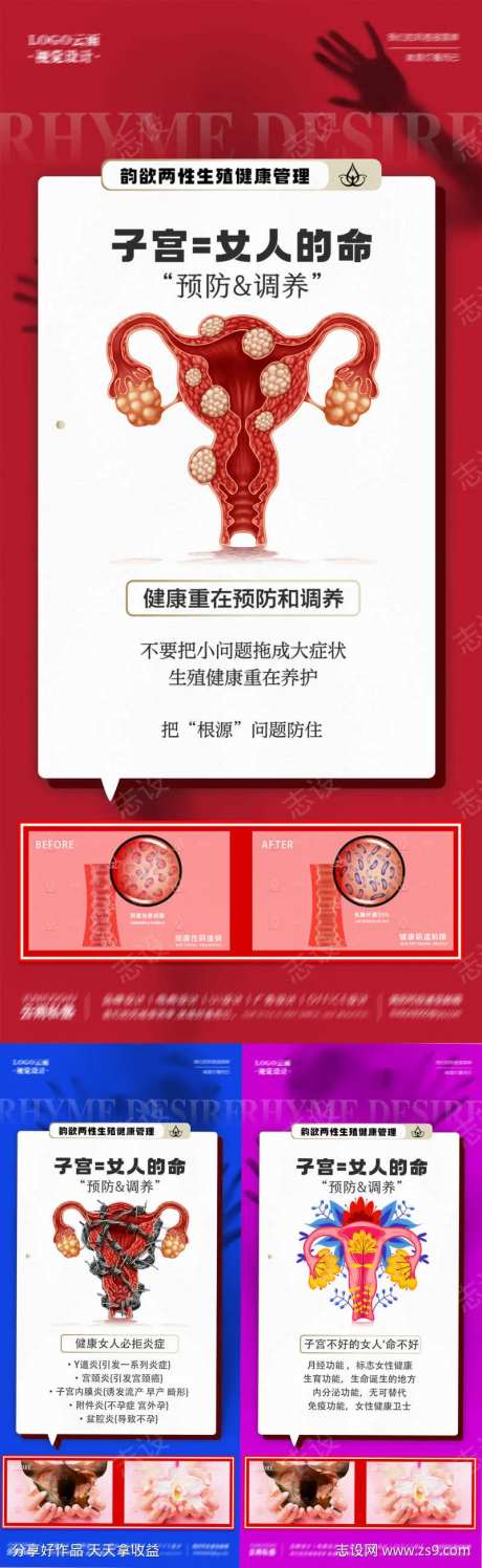 医美私密女性子宫科普系列海报-采灵感-https://www.cailinggan.com/