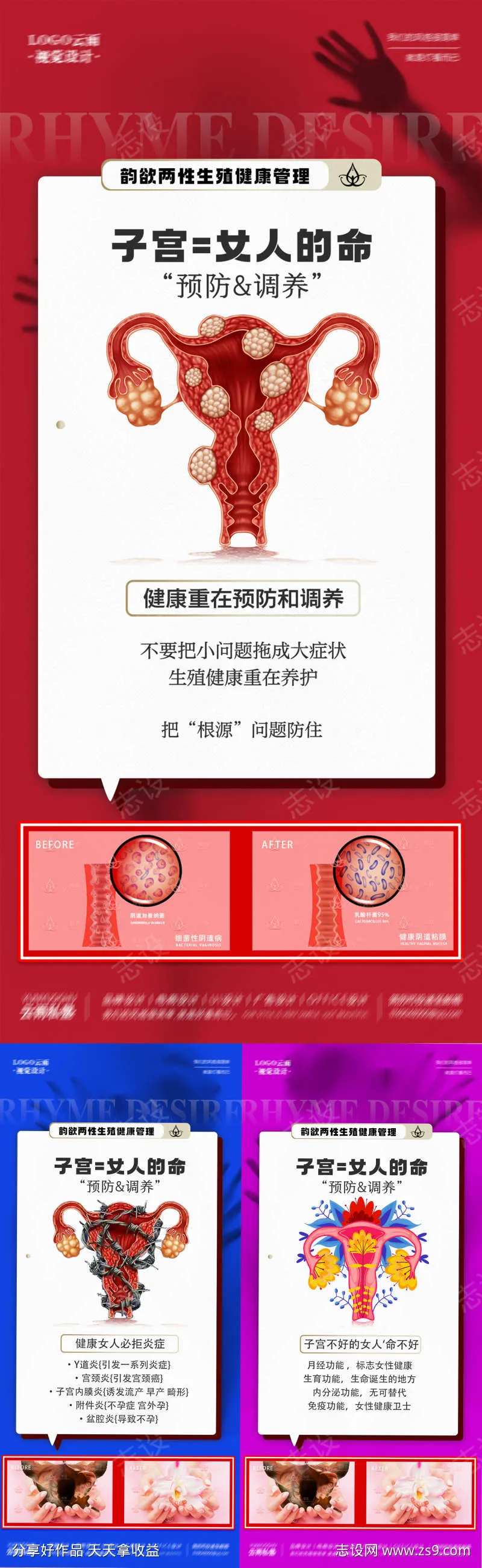医美私密女性子宫科普系列海报-采灵感-cailinggan.com