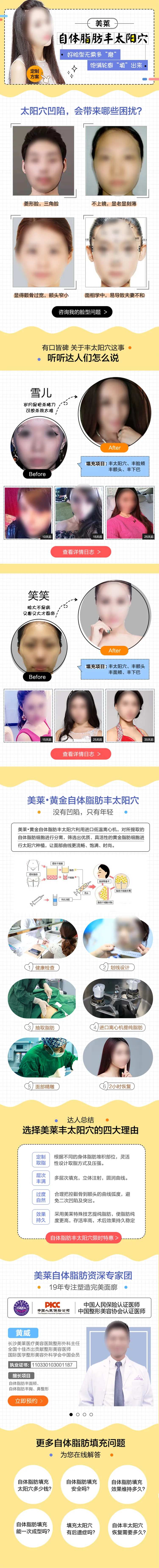 医美自体脂肪丰太阳穴详情页-采灵感-cailinggan.com