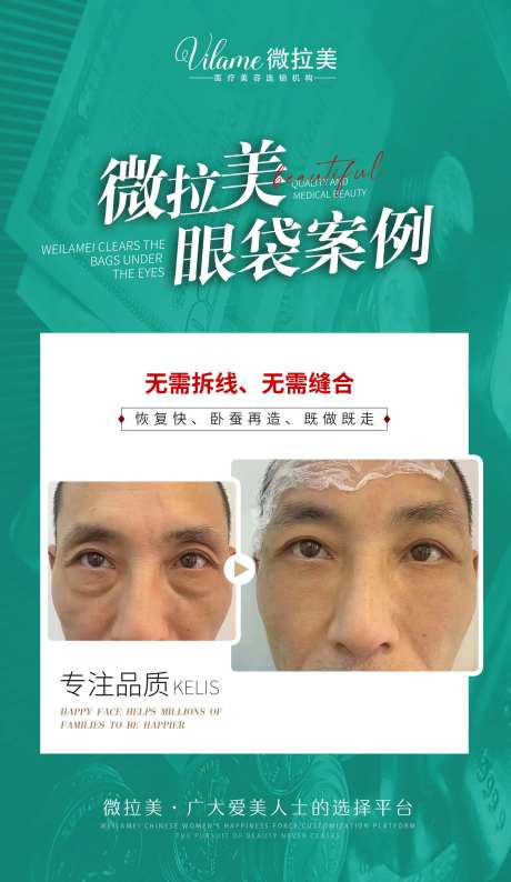 医美案例对比图海报 -采灵感-https://www.cailinggan.com/