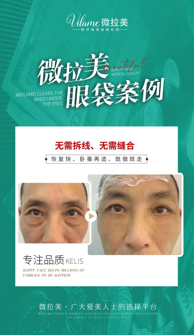 医美案例对比图海报 -采灵感-cailinggan.com