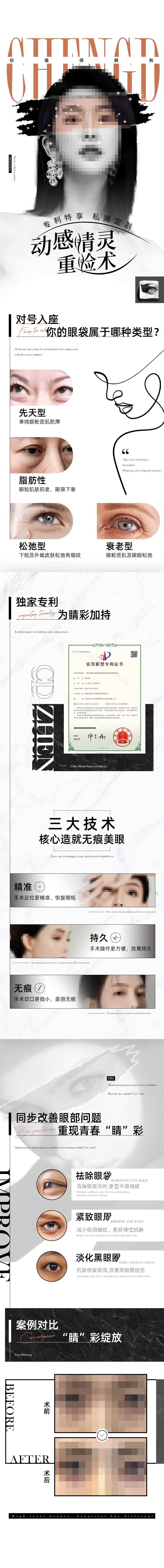 动感睛灵重睑术-采灵感-cailinggan.com