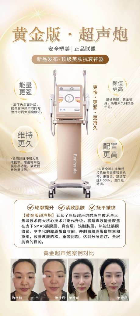 黄金版超声炮介绍-采灵感-https://www.cailinggan.com/