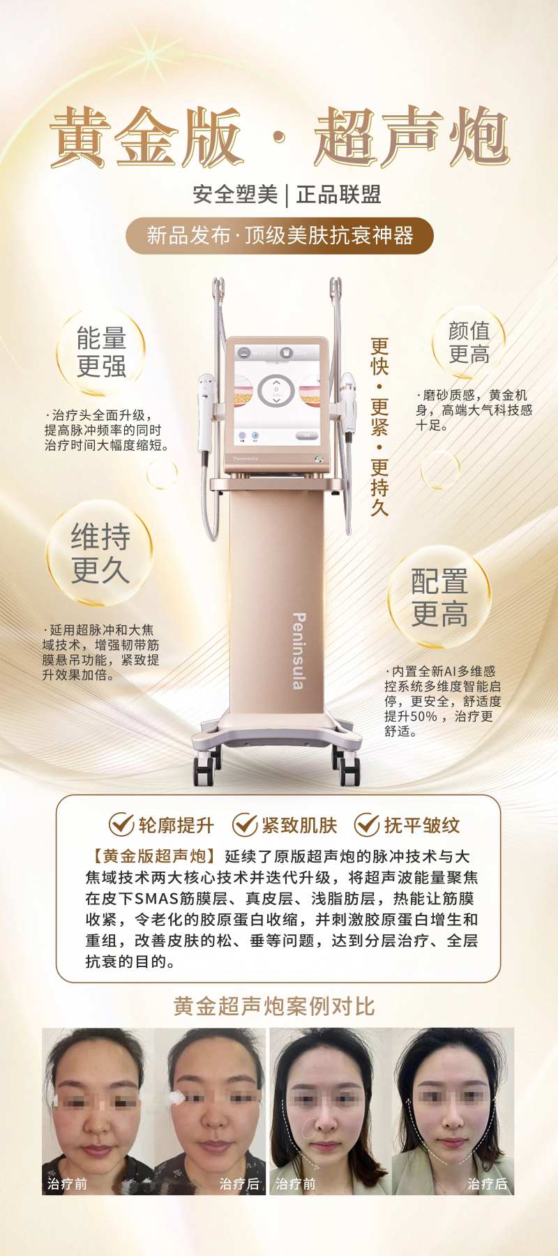 黄金版超声炮介绍-采灵感-cailinggan.com