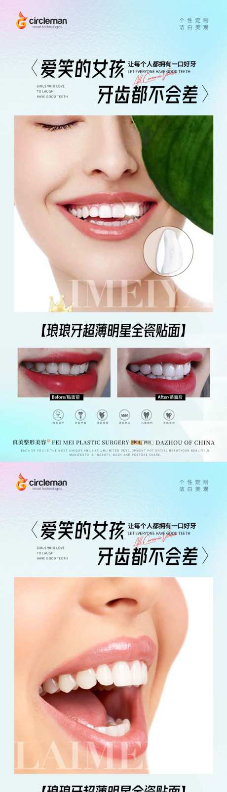 口腔瓷贴面海报-采灵感-https://www.cailinggan.com/