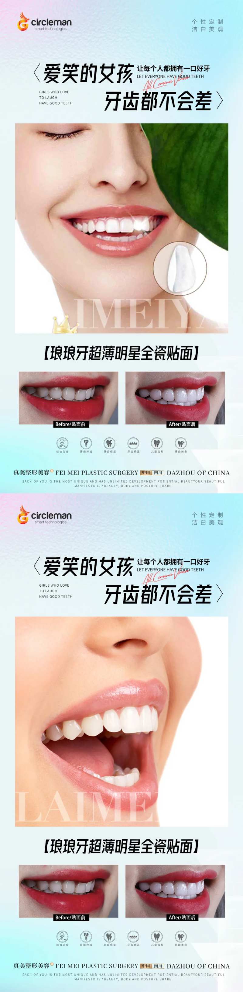 口腔瓷贴面海报-采灵感-cailinggan.com