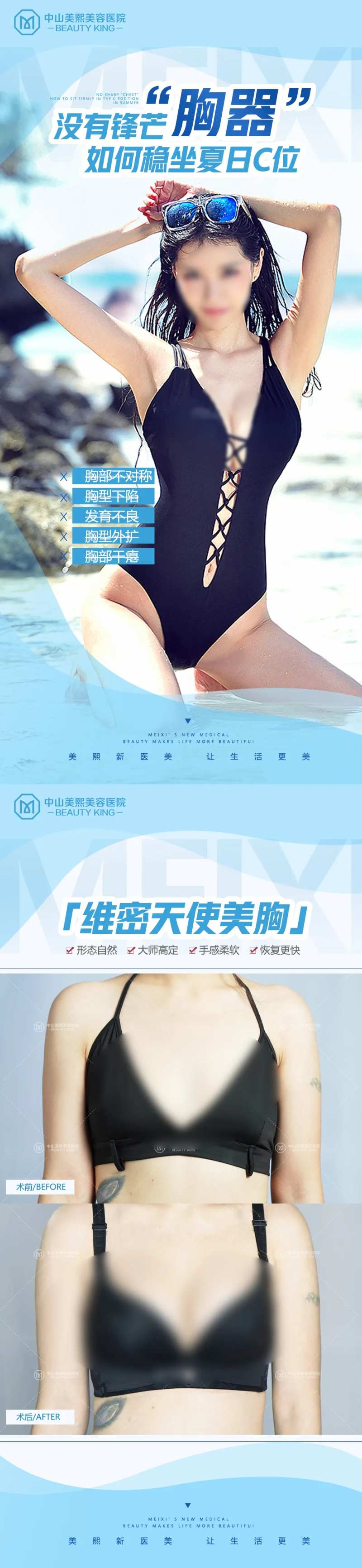 夏日胸部案例助推海报-采灵感-cailinggan.com