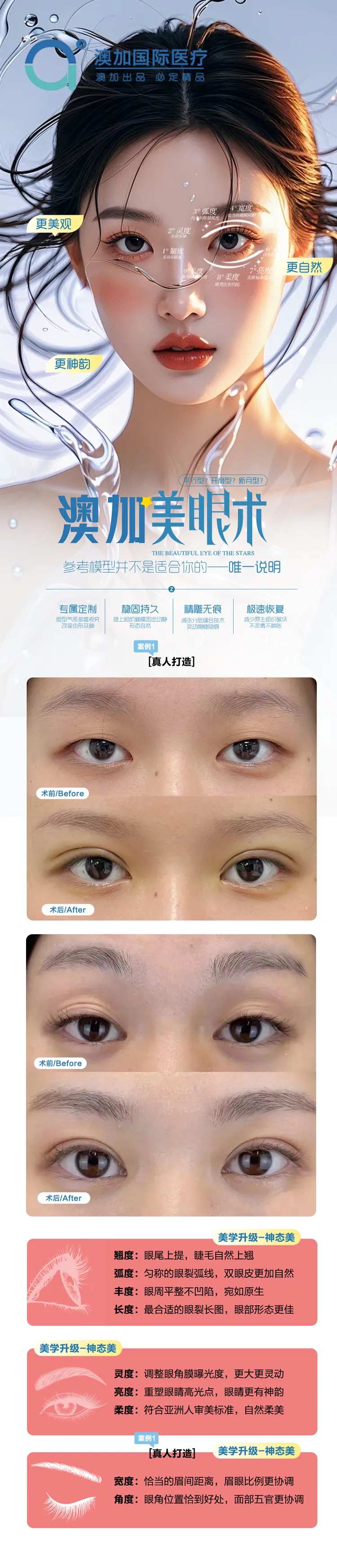 眼综合案例-采灵感-cailinggan.com