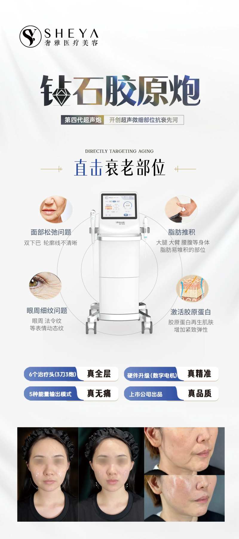 医美仪器超声V拉美超声刀-采灵感-cailinggan.com