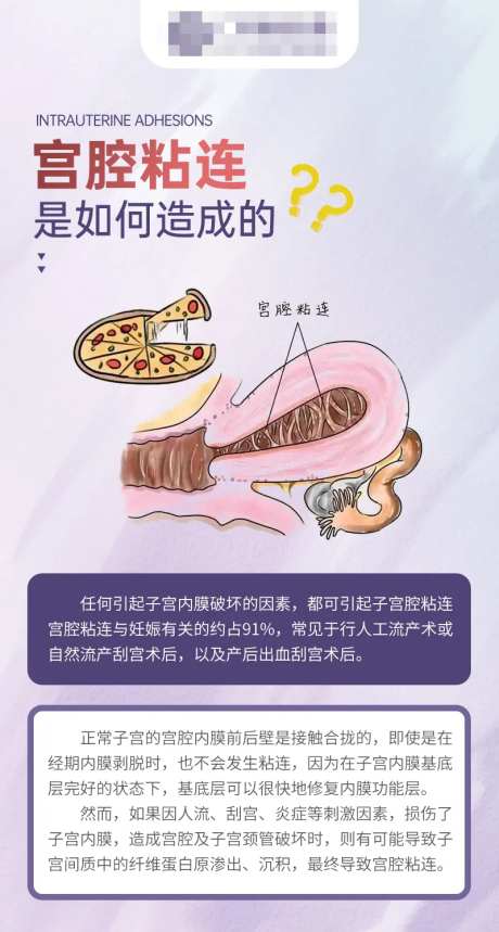 宫腔粘连是如何造成的科普海报-采灵感-https://www.cailinggan.com/