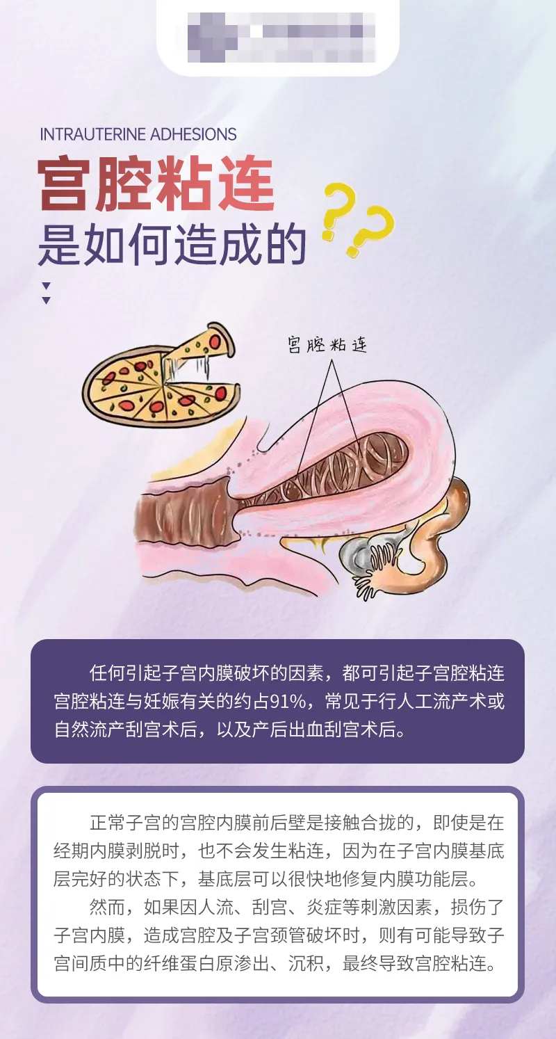 宫腔粘连是如何造成的科普海报-采灵感-cailinggan.com