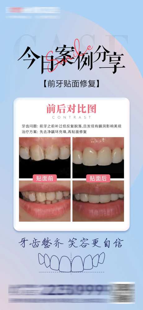 医美口腔案例分享对比海报-采灵感-https://www.cailinggan.com/