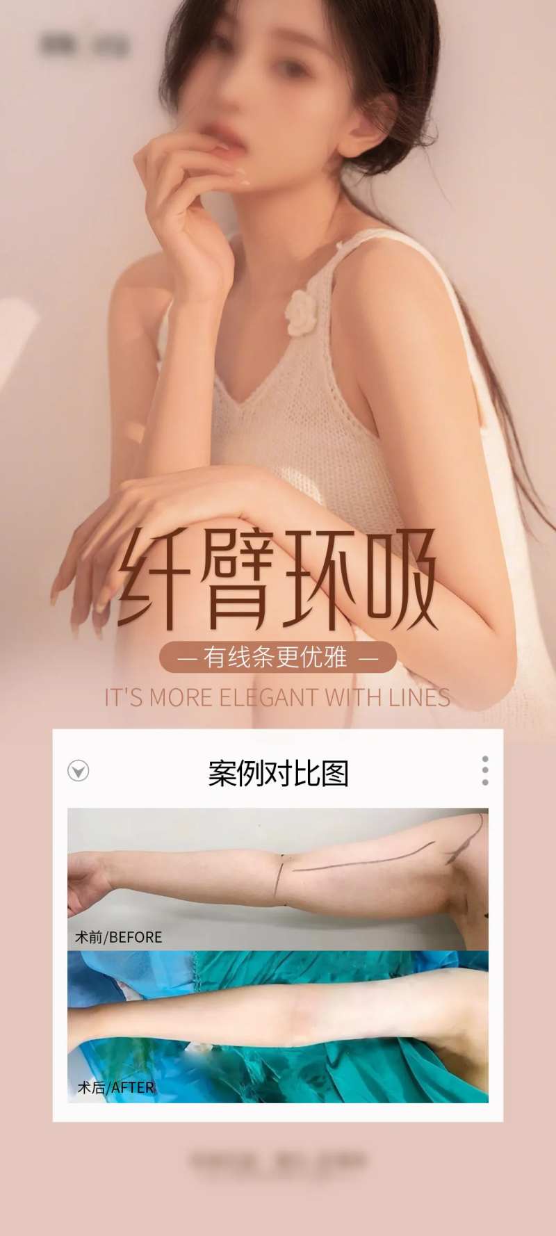 纤臂环吸案例海报-采灵感-cailinggan.com