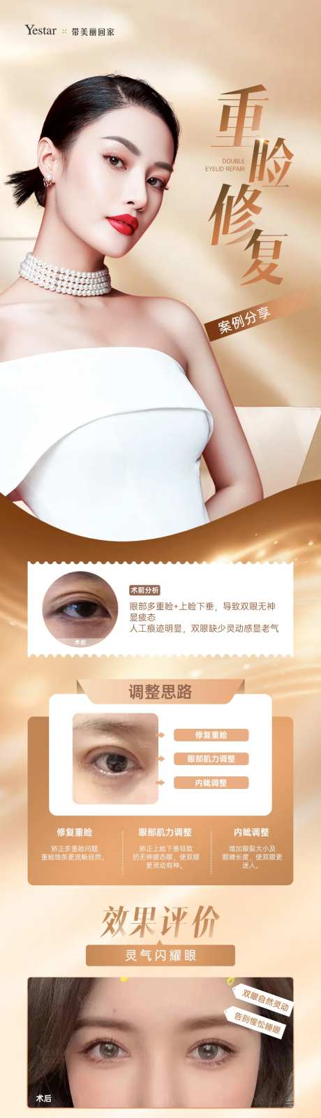 外科眼修复长图-采灵感-https://www.cailinggan.com/
