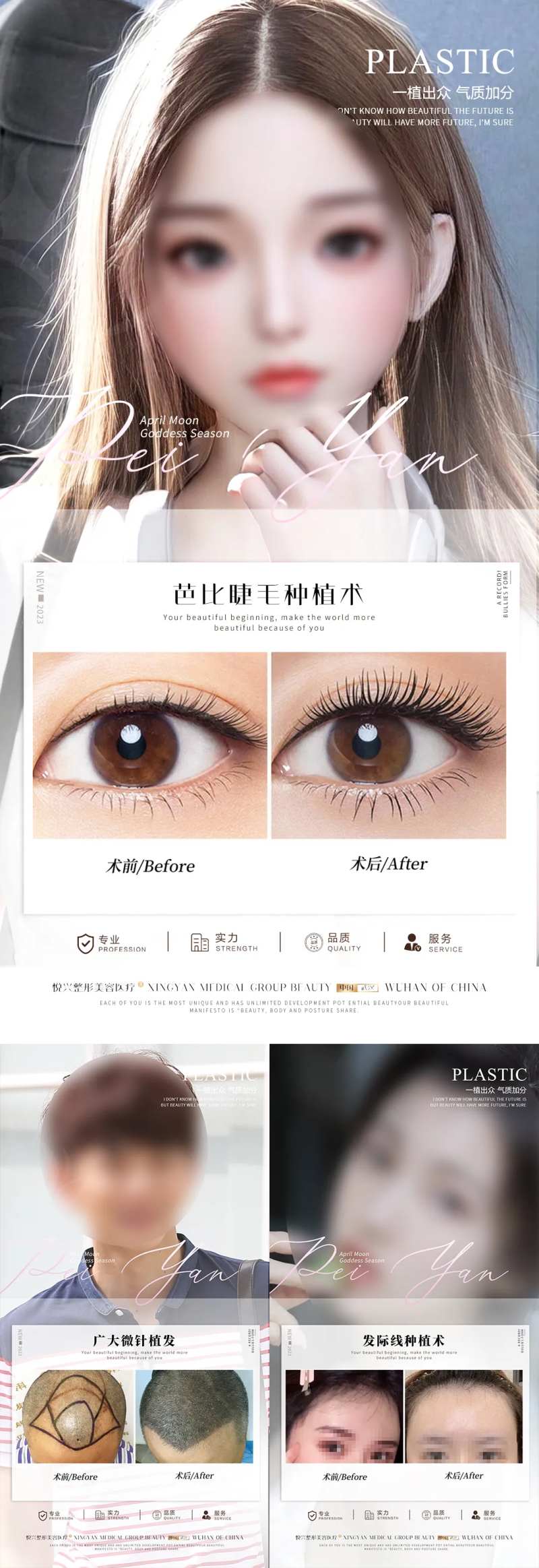 植发案例海报-采灵感-cailinggan.com