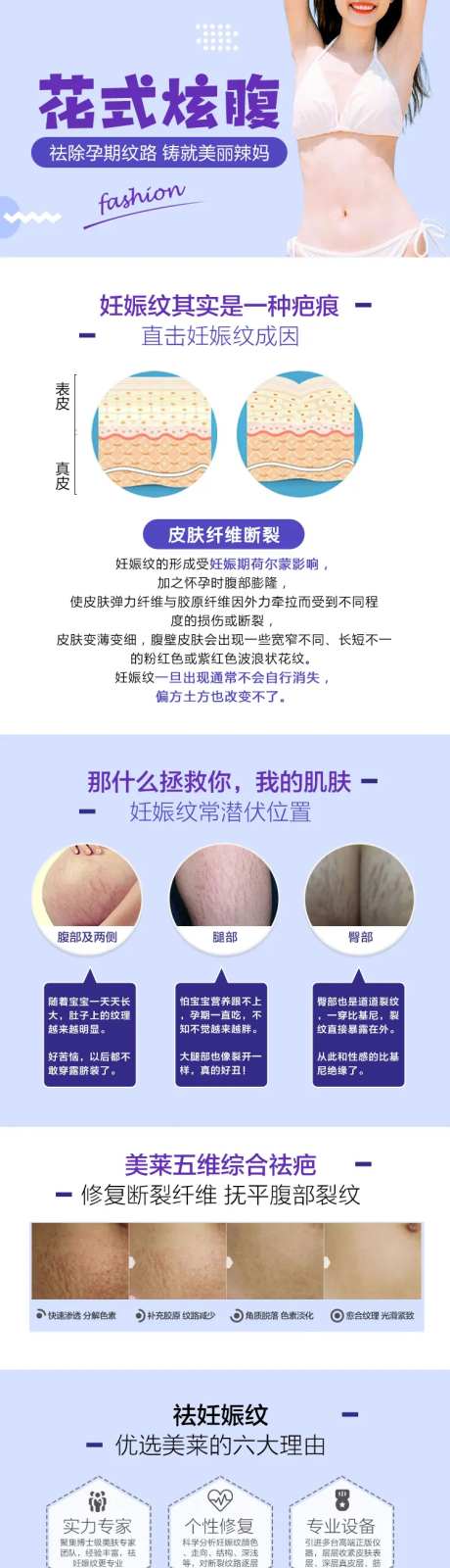 医美激光去妊娠纹详情页-采灵感-https://www.cailinggan.com/