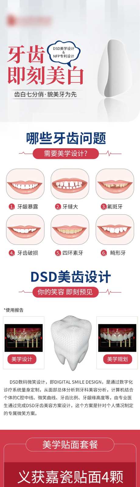 美团店内活动-采灵感-https://www.cailinggan.com/