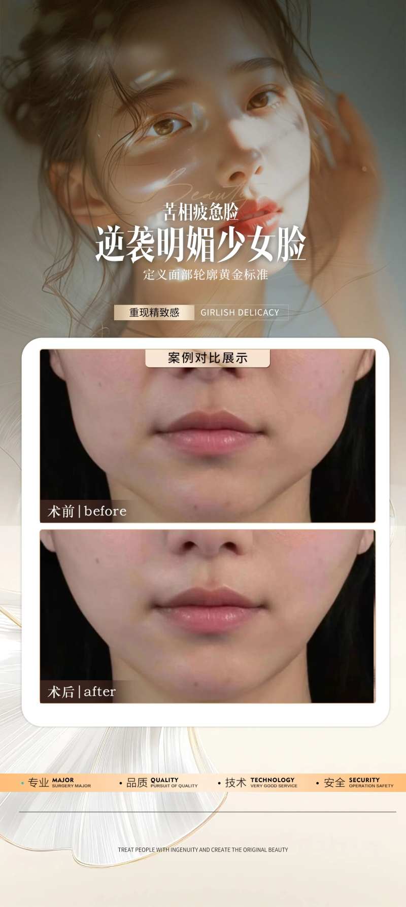 医美外轮廓案例海报-采灵感-cailinggan.com