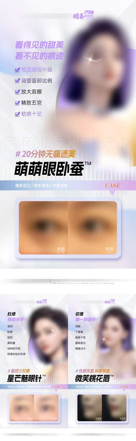 医美面部注射项目案例图海报-采灵感-https://www.cailinggan.com/