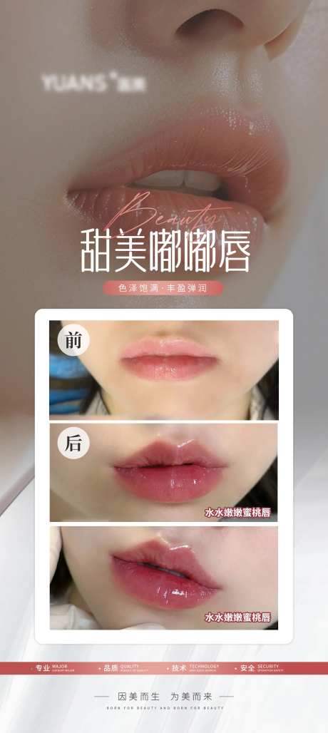 医美嘴巴丰唇案例海报-采灵感-https://www.cailinggan.com/