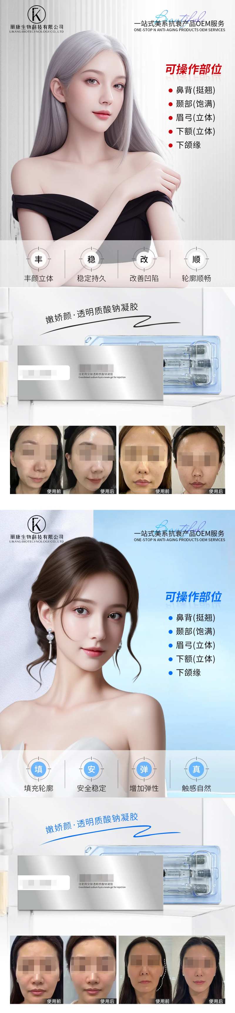 大分子玻尿酸填充-采灵感-cailinggan.com