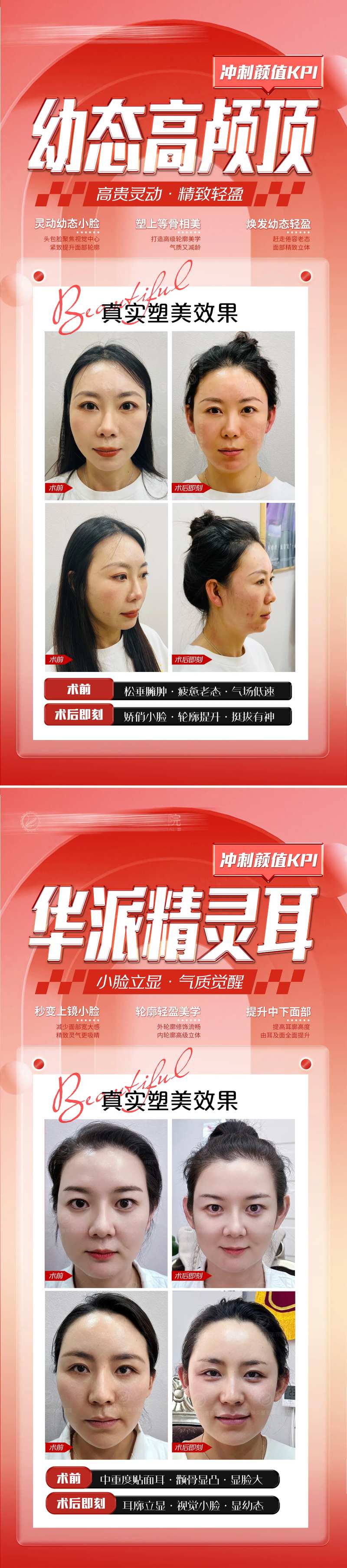 医美高颅顶海报展架-采灵感-cailinggan.com