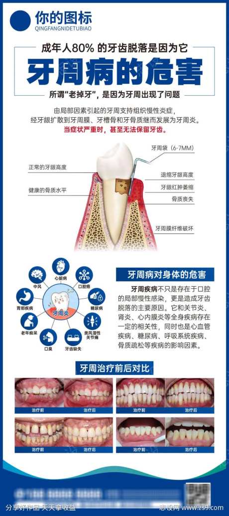 牙周活动展架                                                                                                                                                                                                  -采灵感-https://www.cailinggan.com/