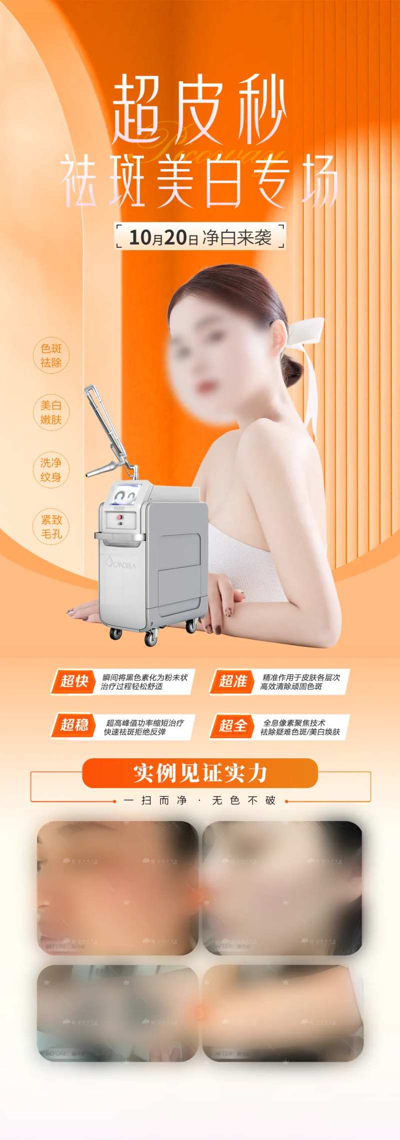 医美专场超皮秒专场模特-采灵感-cailinggan.com