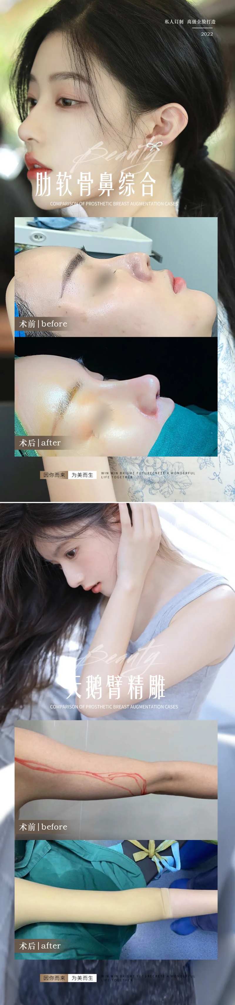 医美隆鼻吸脂整形案例系列海报-采灵感-cailinggan.com