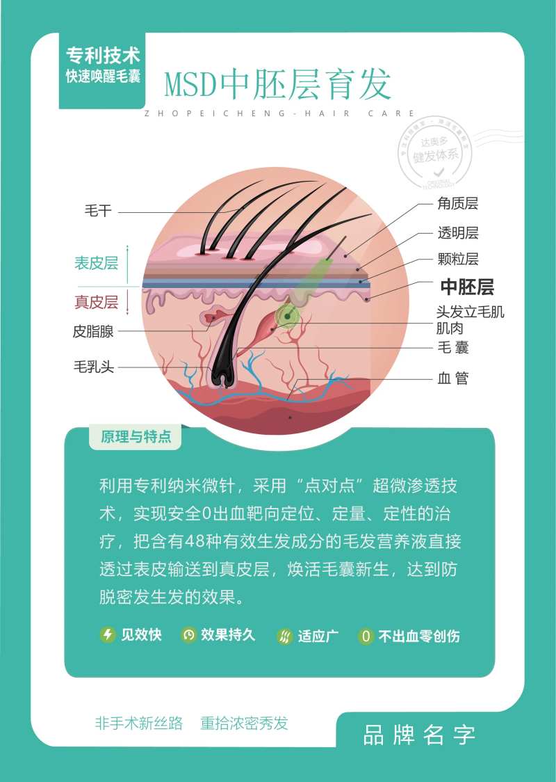 植发毛囊图宣传海报展板-采灵感-cailinggan.com