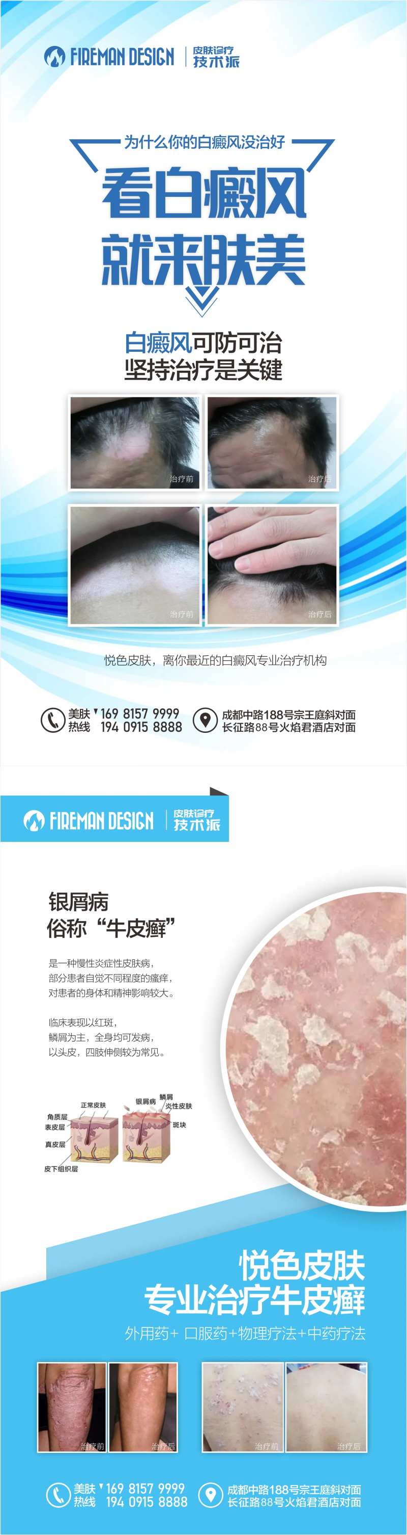 白癜风银屑病宣传海报-采灵感-cailinggan.com