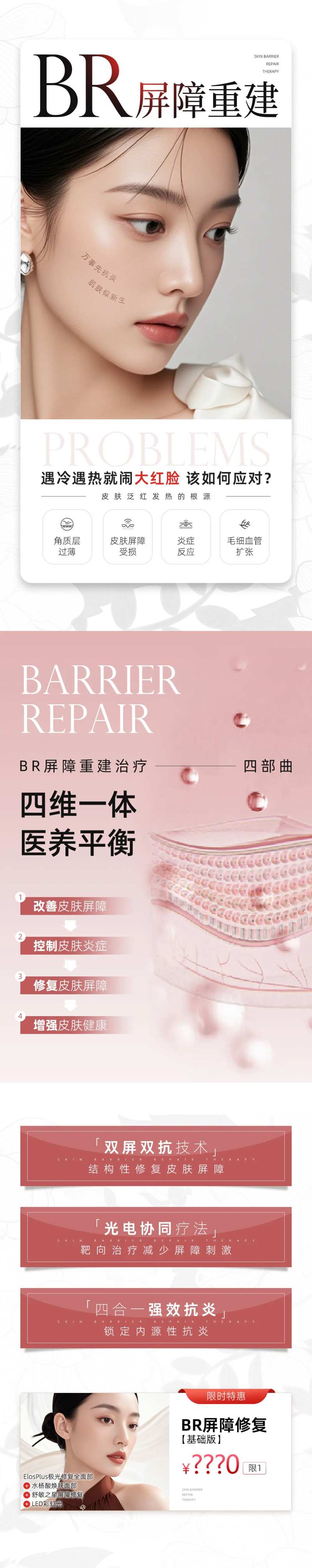 BR屏障重建-采灵感-cailinggan.com