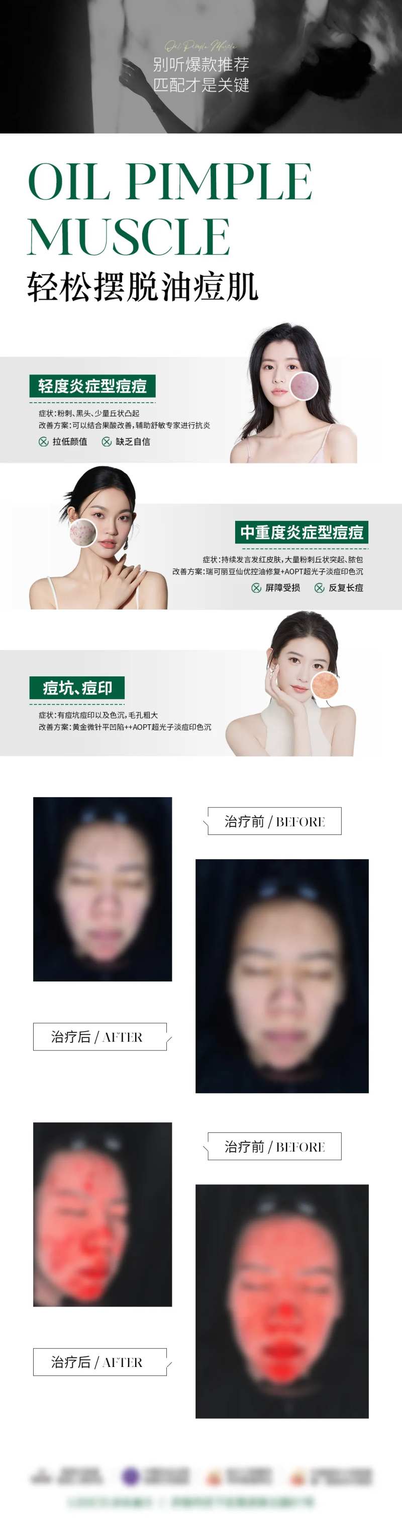 轻松摆脱油痘肌海报-采灵感-cailinggan.com