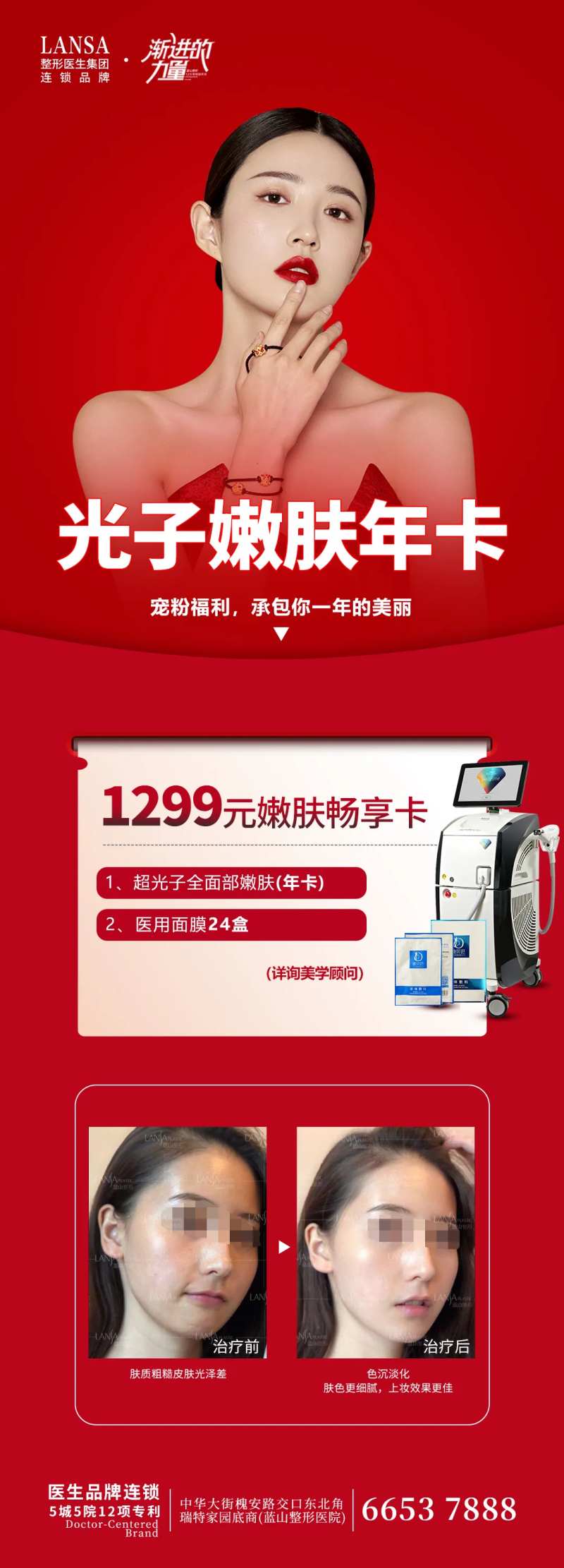 光子嫩肤-采灵感-cailinggan.com