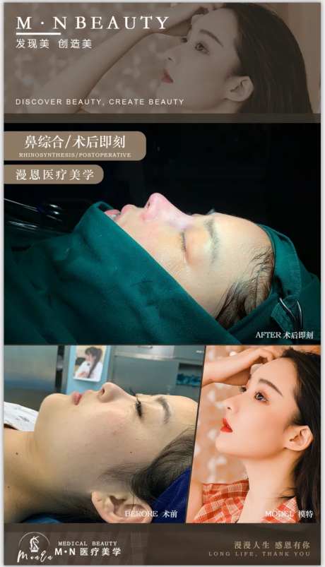 医美案例对比图-采灵感-https://www.cailinggan.com/