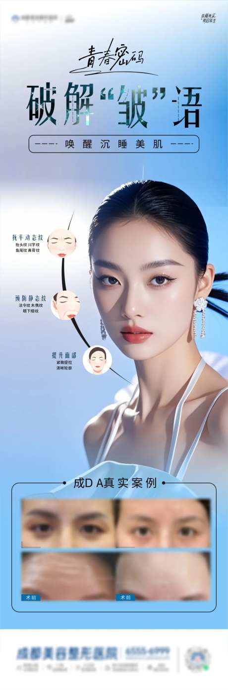 肉毒素除皱海报-采灵感-https://www.cailinggan.com/