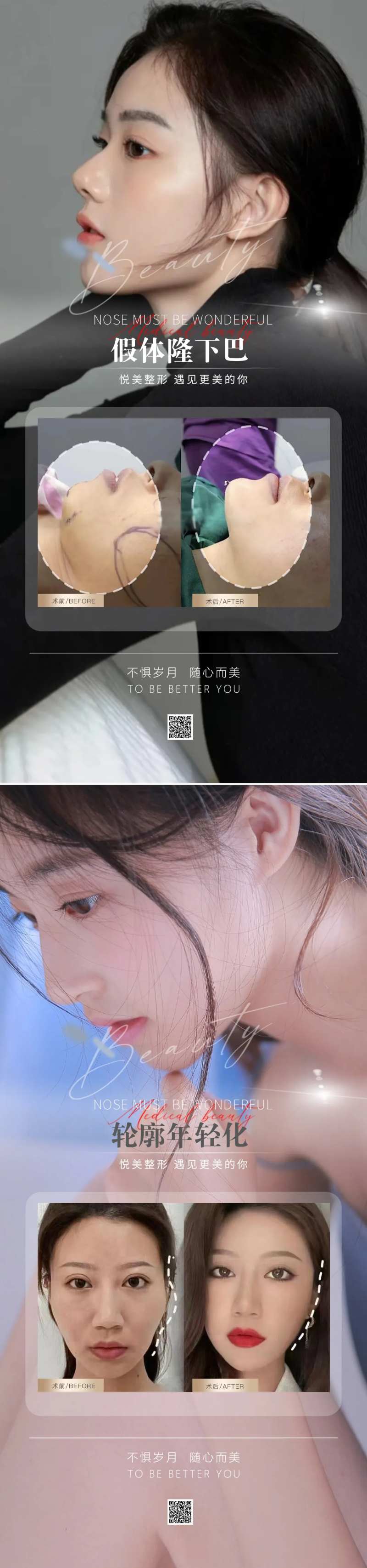 医美隆鼻案例对比图-采灵感-cailinggan.com