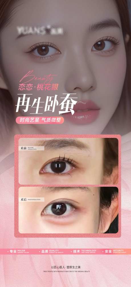 医美卧蚕案例对比-采灵感-https://www.cailinggan.com/