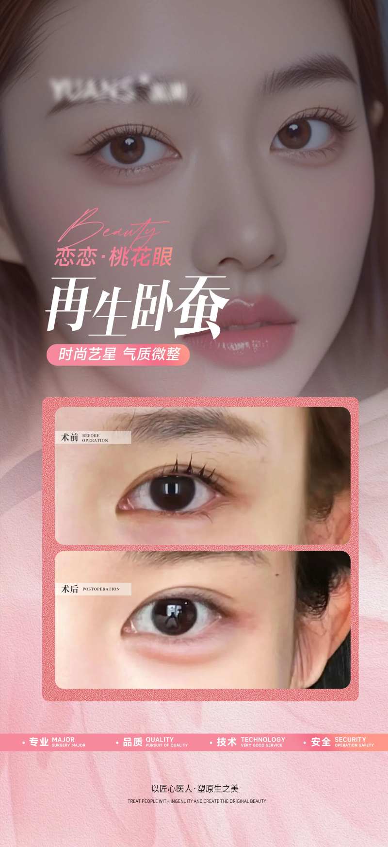 医美卧蚕案例对比-采灵感-cailinggan.com