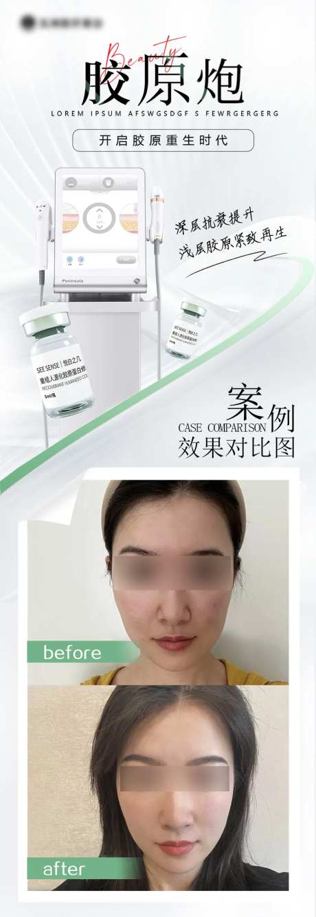 医美活动长图-采灵感-cailinggan.com